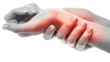 بیماری آرتریت آرتریت روماتوئید بهتر بشناسیم