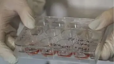 درمان فلج با استفاده از ایمپلنت‌های ستون فقرات