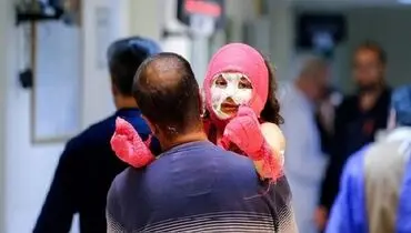 اولین حادثه چهارشنبه‌سوری رقم خورد | آخرین وضعیت مصدومیت دو کودک ۱۰ و ۱۱ ساله
