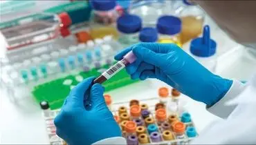 روش جدید محققان چینی در تشخیص سرطان ریه