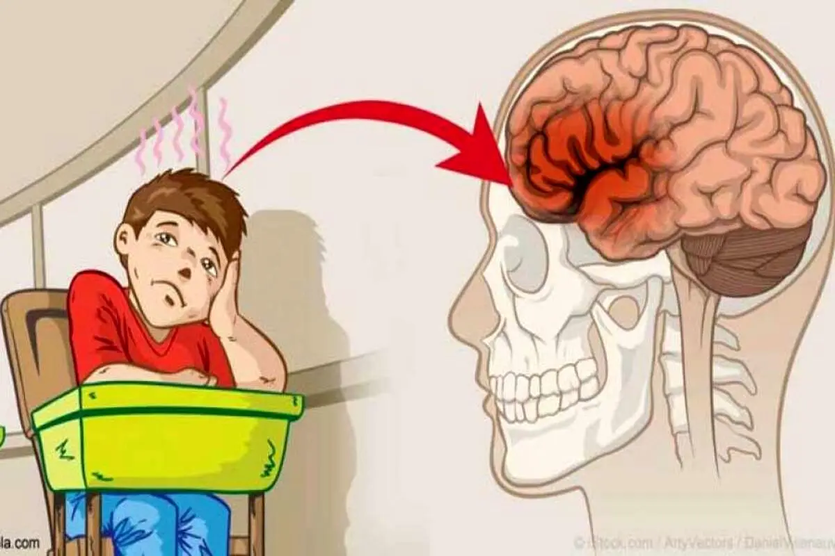 نشانههای مغز بیش فعال کدامند؟