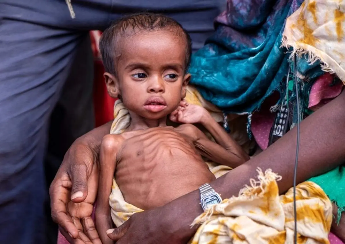 افزایش گرسنگی در شاخ آفریقا در پی جنگ اوکراین