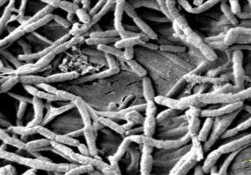 آیا می دانستید: هفته ای یک کارت اعتباری می خورید! / 8 منبع اصلی میکروپلاستیک
