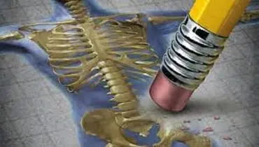 هورمون طبیعی جایگزین دارو برای درمان پوکی استخوان