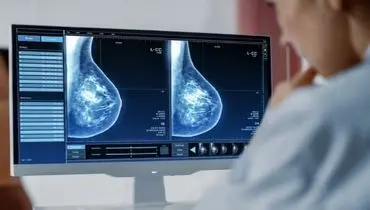 یافته جدید محققان در خصوص پیش بینی بازگشت دوباره سرطان سینه