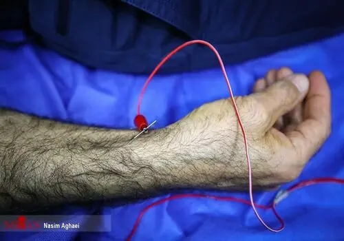 حجامت کنیم یا خون اهدا کنیم؟