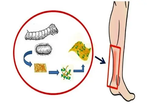 توصیه کارشناسان برای پیشگیری از آسیب تاندون‌ها
