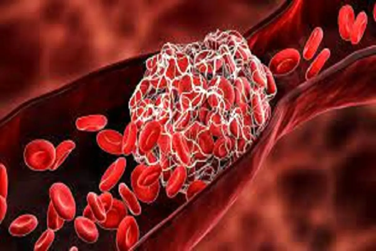 پروتئین های آزاد شده در خون منجر به نشت رگ های خونی
