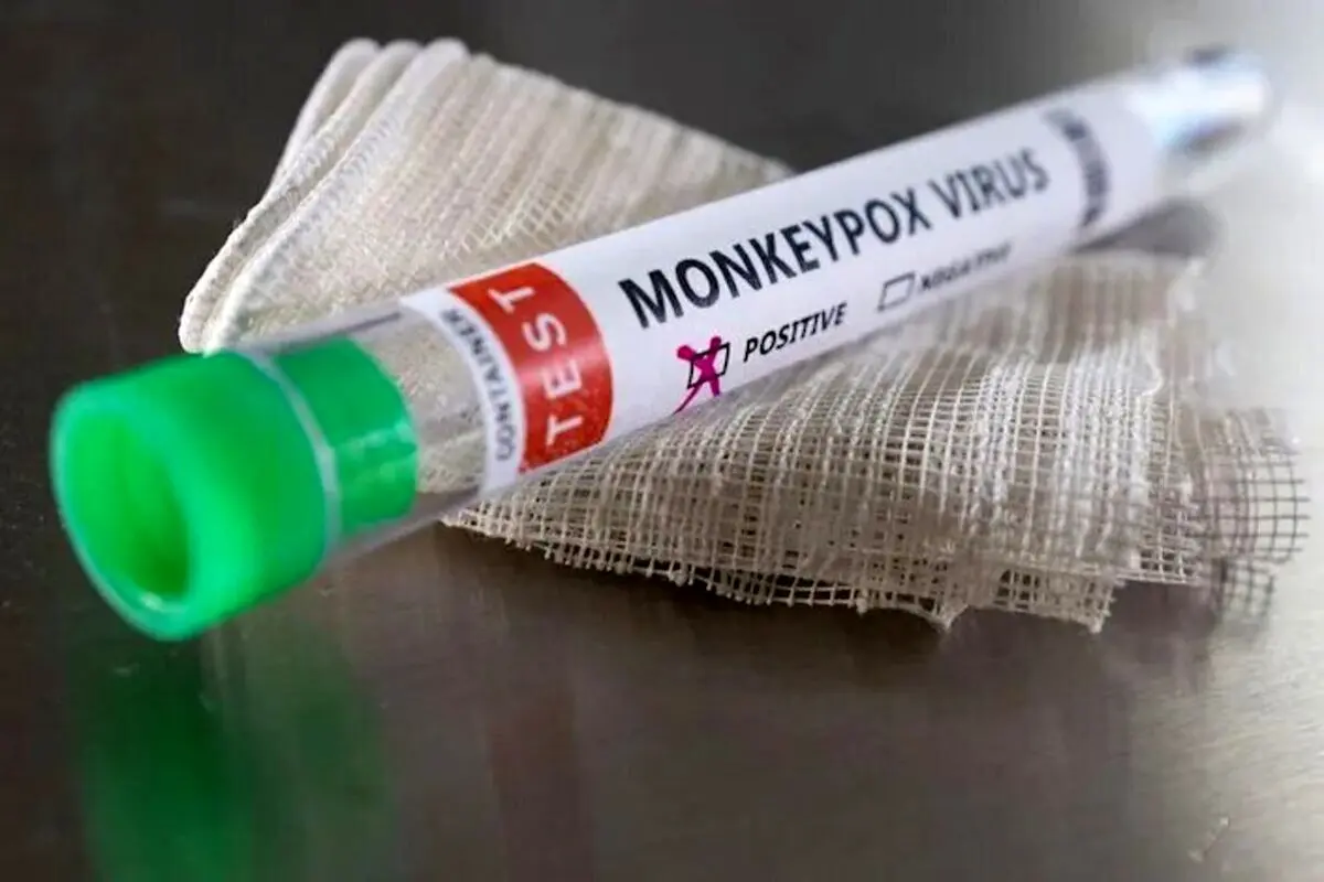 انگلستان ۳۶ مورد جدید آبله میمونی شناسایی می‌کند| آبله میمونی ممکن است با بیماری‌های آمیزشی اشتباه شود