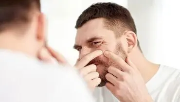 با خوردن این غذاها آکنه را درمان کنید