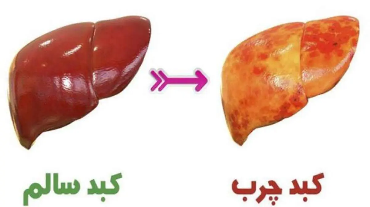راه داشتن کبد سالم