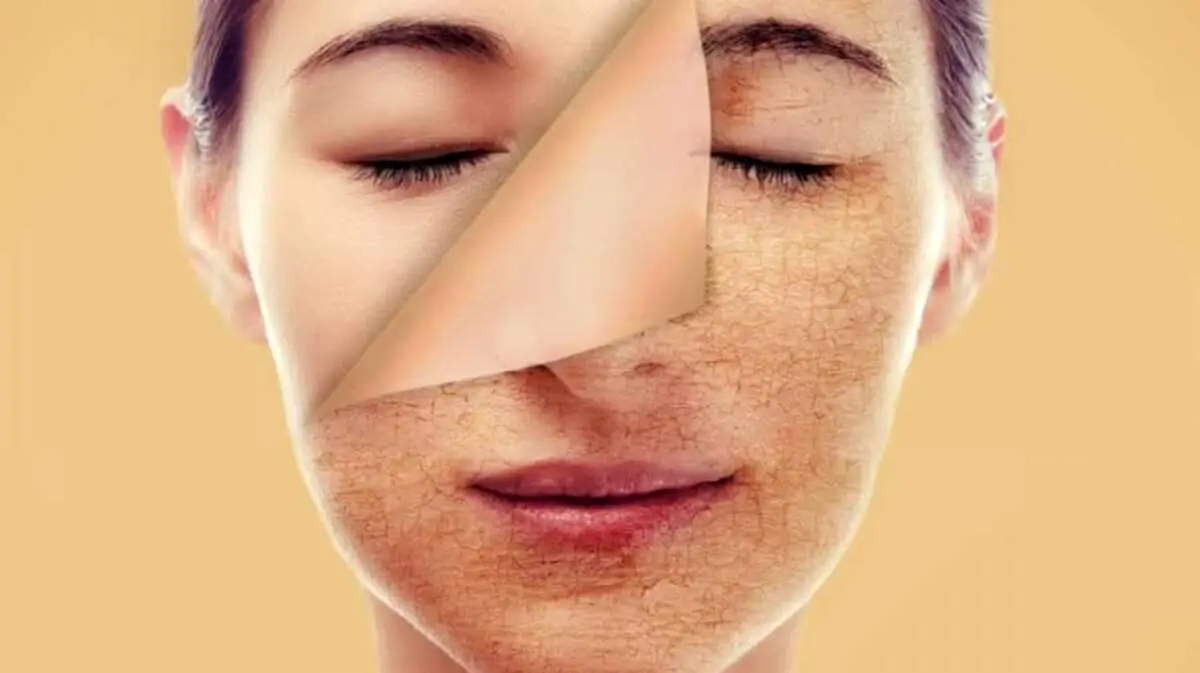 مراقبت های روزانه از پوست