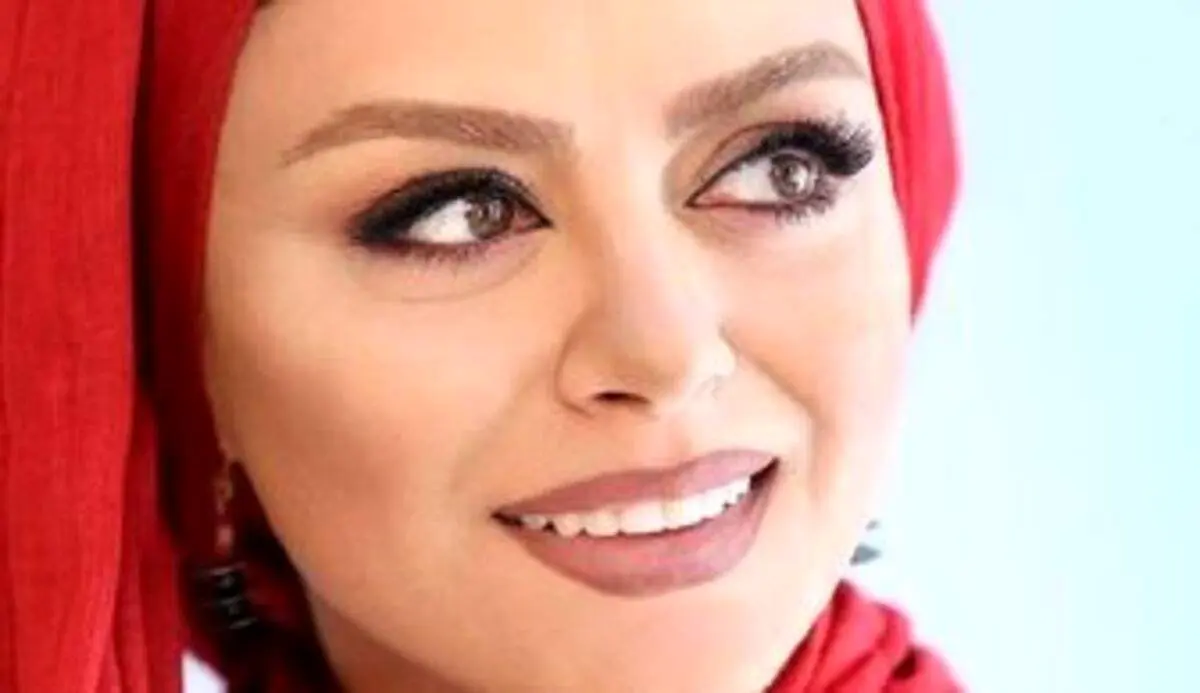 تغییر چهره ناگهانی شبنم فرشادجو