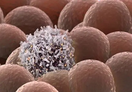 وظیفه جدید پهپادها اینبار کشتار سلول‌هاس سرطانی