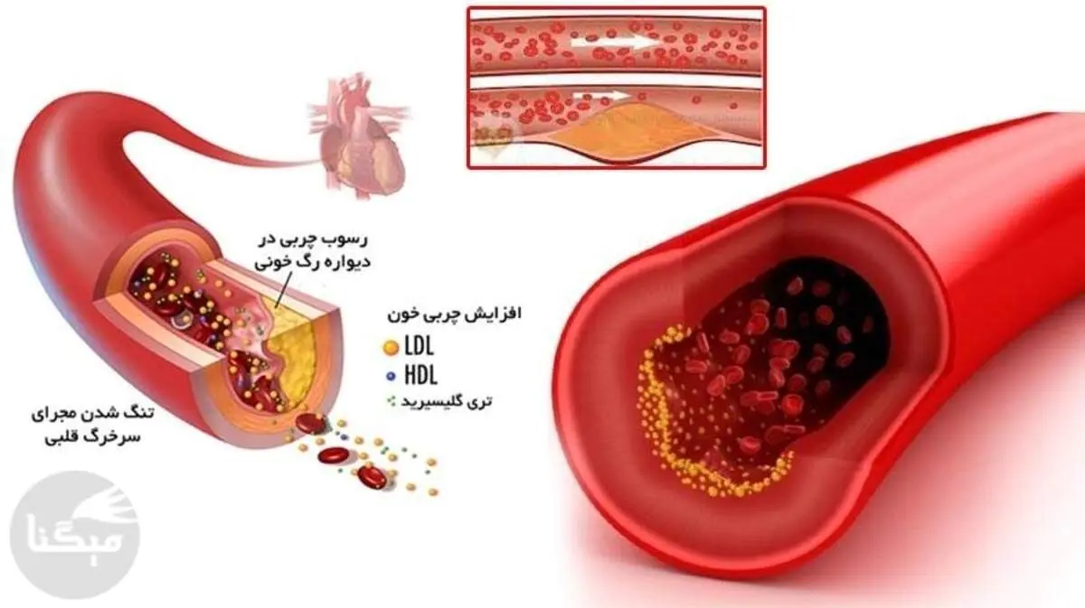 تغذیه پیشنهادی برای درمان چربی خون بالا