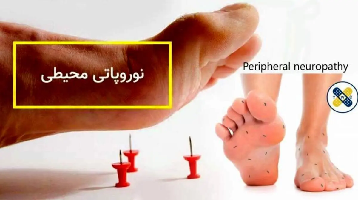 نوروپاتی محیطی چیست؟