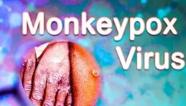 ویروس آبله میمون نمی تواند در بدن انسان تثبیت شود