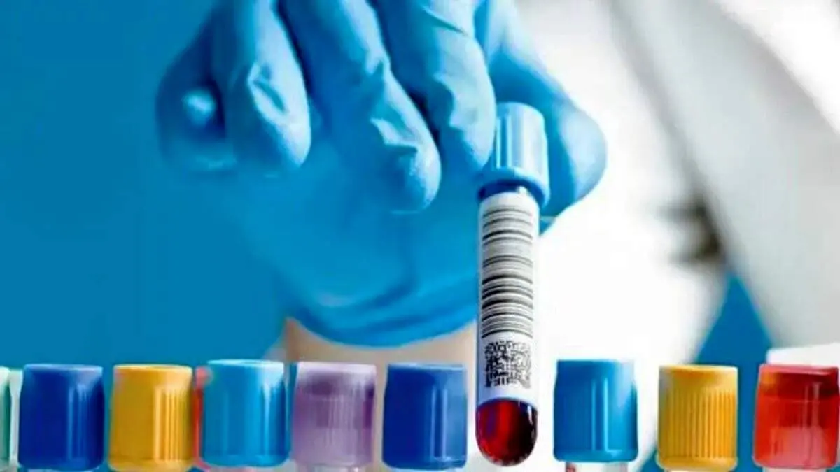 یک تست جدید ایمنی درازمدت شما در برابر کرونا را اندازه می‌گیرد