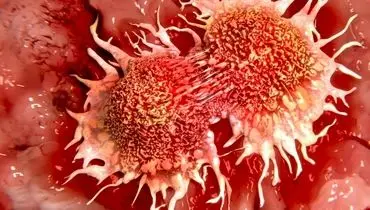 سلول‌های سرطانی کدام قسمت‌های بدن را دوست دارند؟