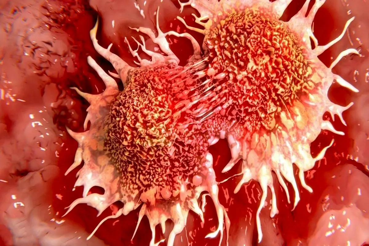 سلول‌های سرطانی کدام قسمت‌های بدن را دوست دارند؟