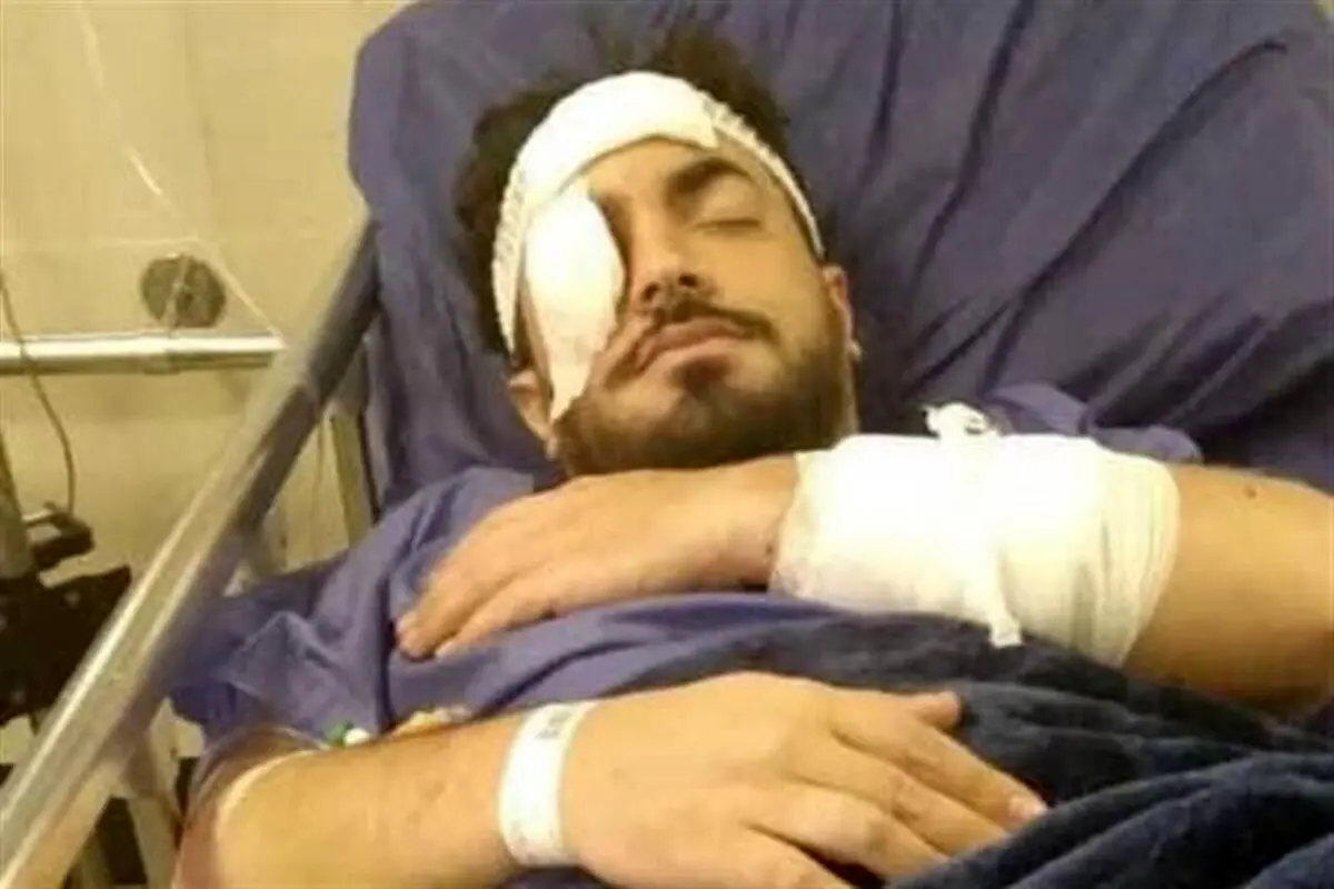 حمله به یک روحانی در تهرانپارس + عکس