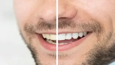 ۵ قانون به ظاهر ساده و مهم در مسواک زدن