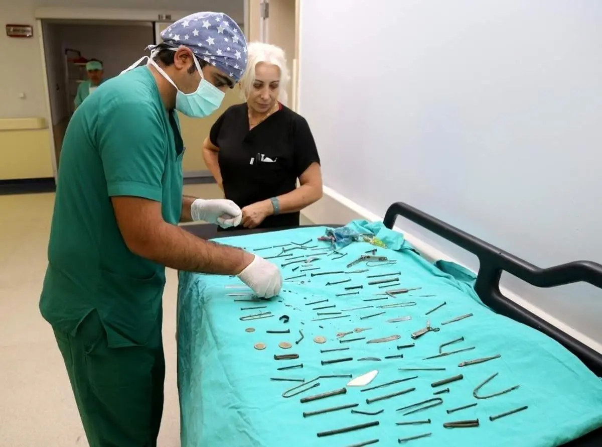 اتفاقی عجیب و باور نکردنی/ خارج کردن ۱۵۸ شی فلزی از معده یک زن!+ فیلم