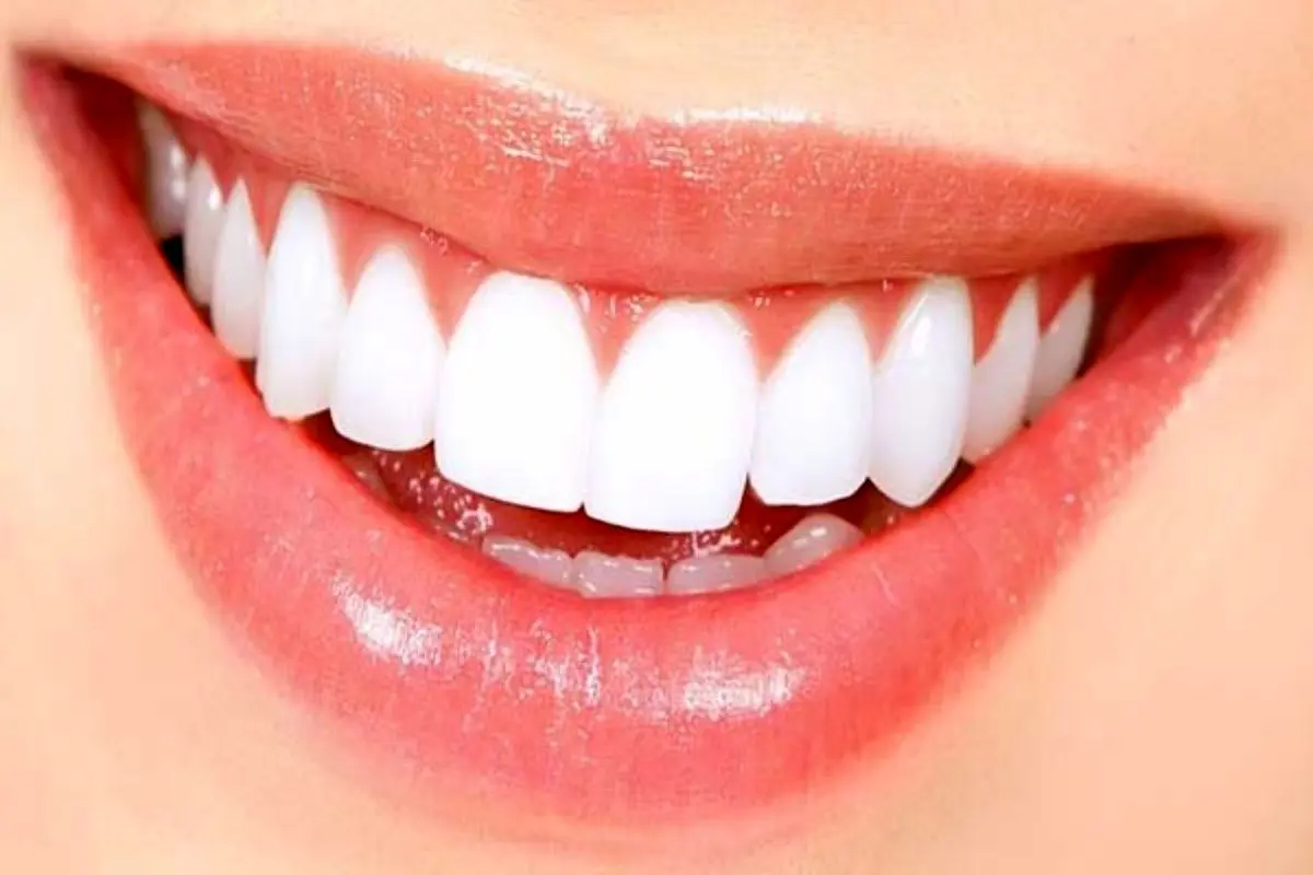 ۵ راهکار موثر جهت سفید کردن دندان‌ها