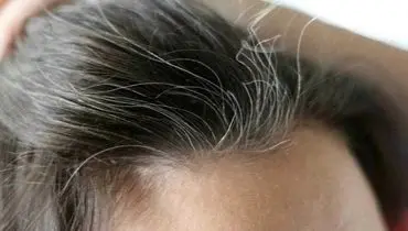 آیا سفید شدن موها قابل پیشگیری است؟

