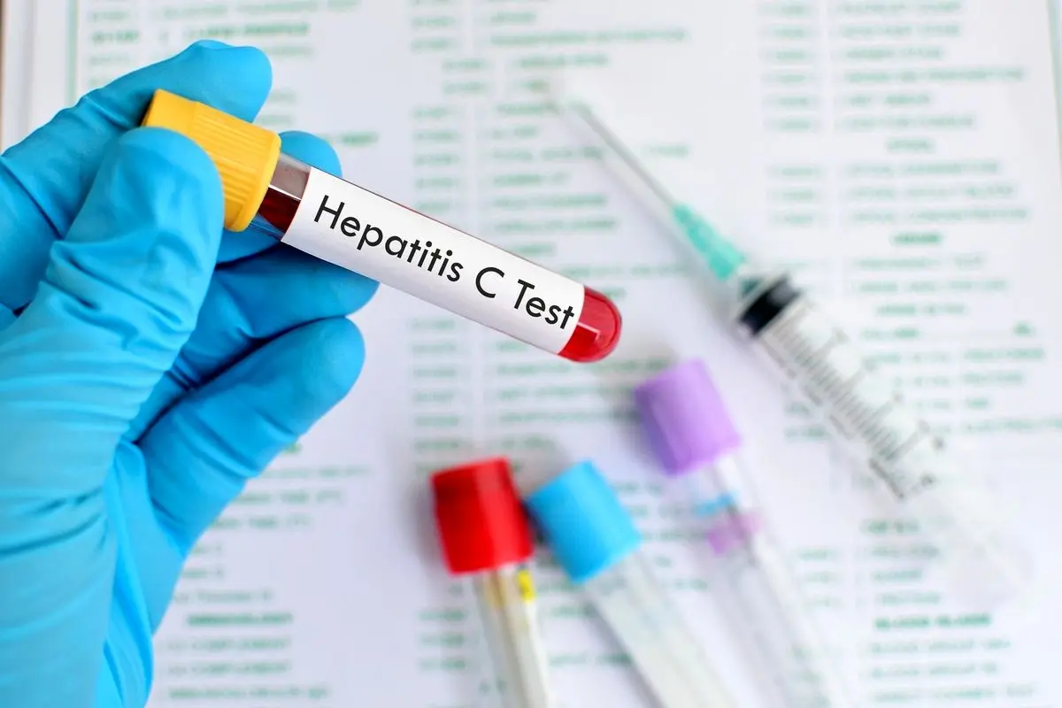 دانستنی هایی درباره هپاتیت که به گوشتان نخورده+راههای پیشگیری