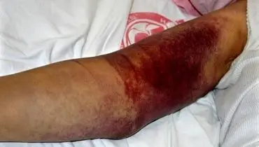 اعلام جزئیات مرگ یک بیمار ۳۸ساله | علت فوت جوان خوزستانی با وجود مراجعه به بیمارستان چه بود؟