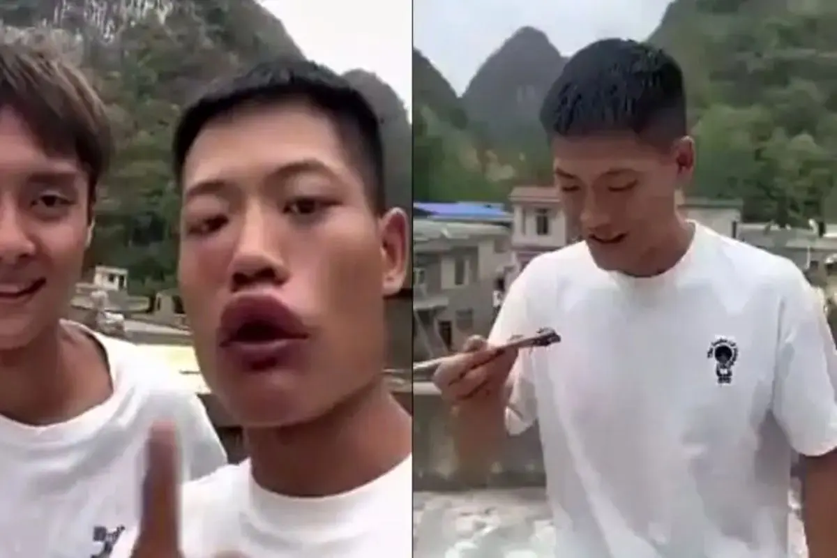 عاقبت وحشتناک یک سلبریتی بعد از خوردن زنبور! + فیلم