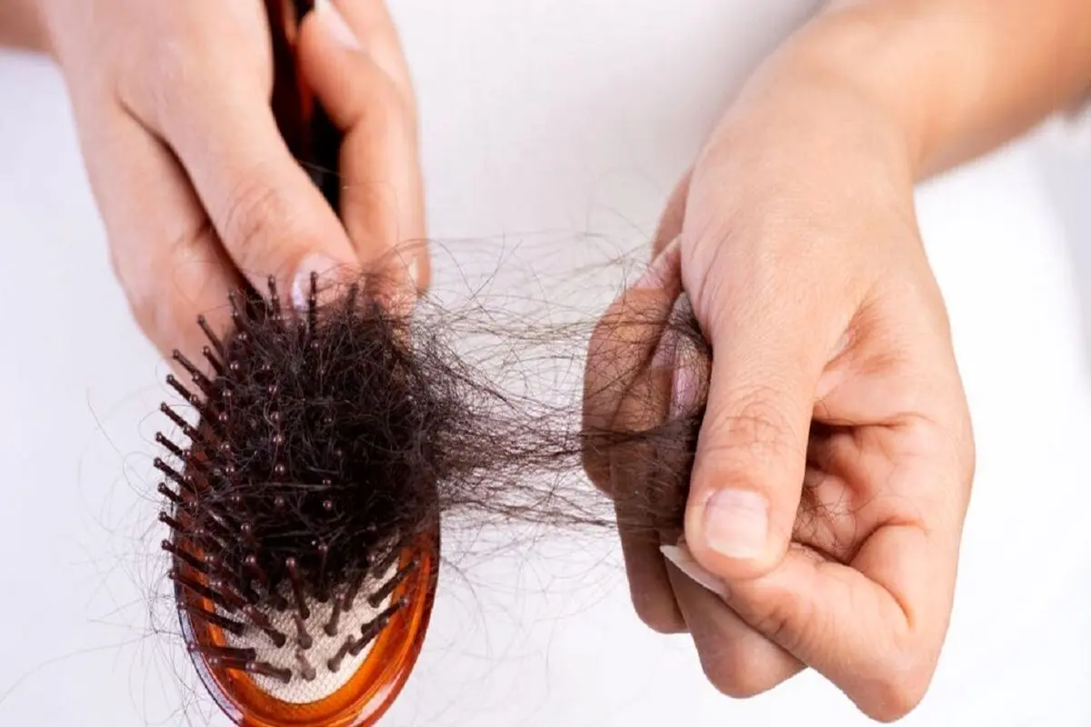 موثرترین روش ها برای کاهش ریزش مو