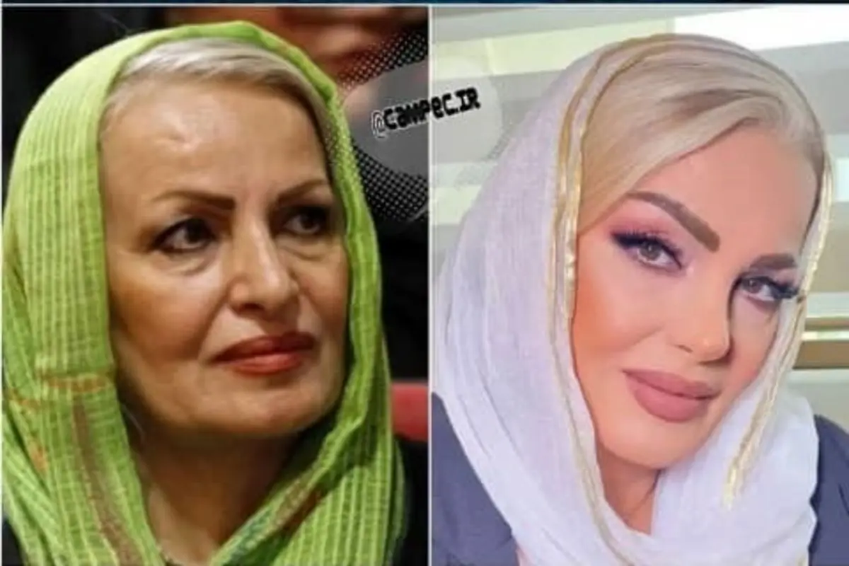 تغییر چهره جنجالی خانم بازیگر در ۶۲ سالگی! + تصاویر