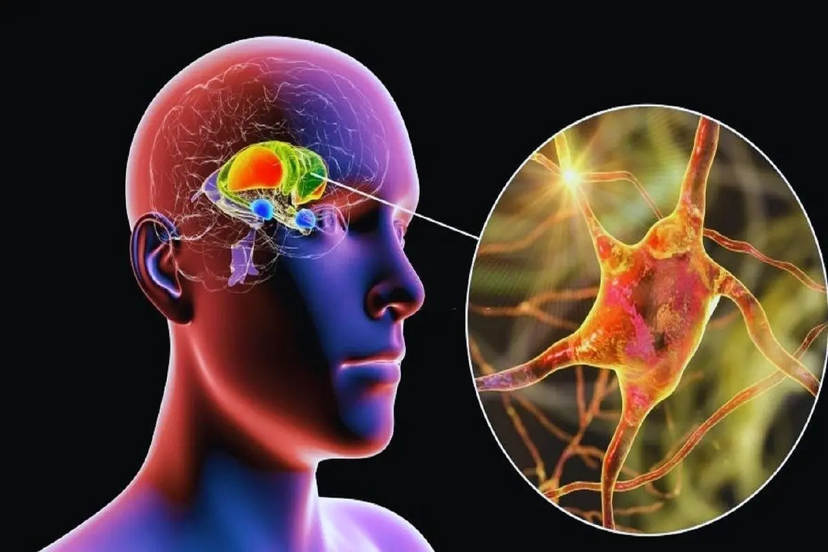 کاشت دستگاهی در مغز که باعث لاغری میشود