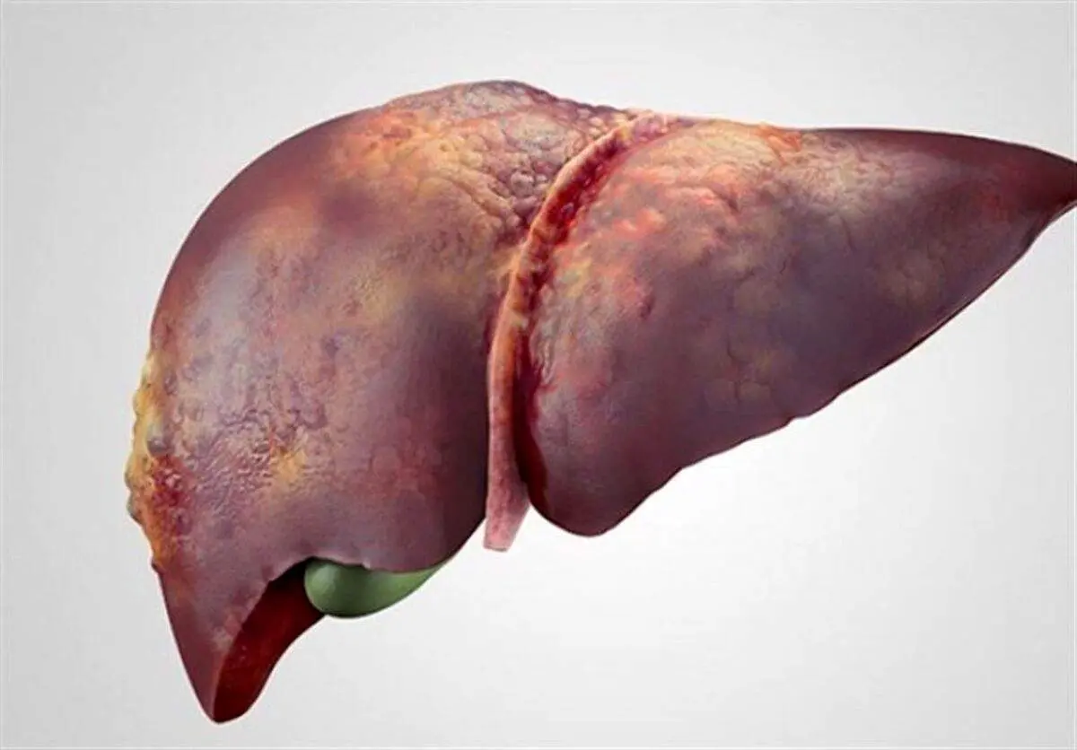 علائم سردی کبد چیست؟