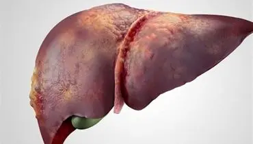 علائم سردی کبد چیست؟