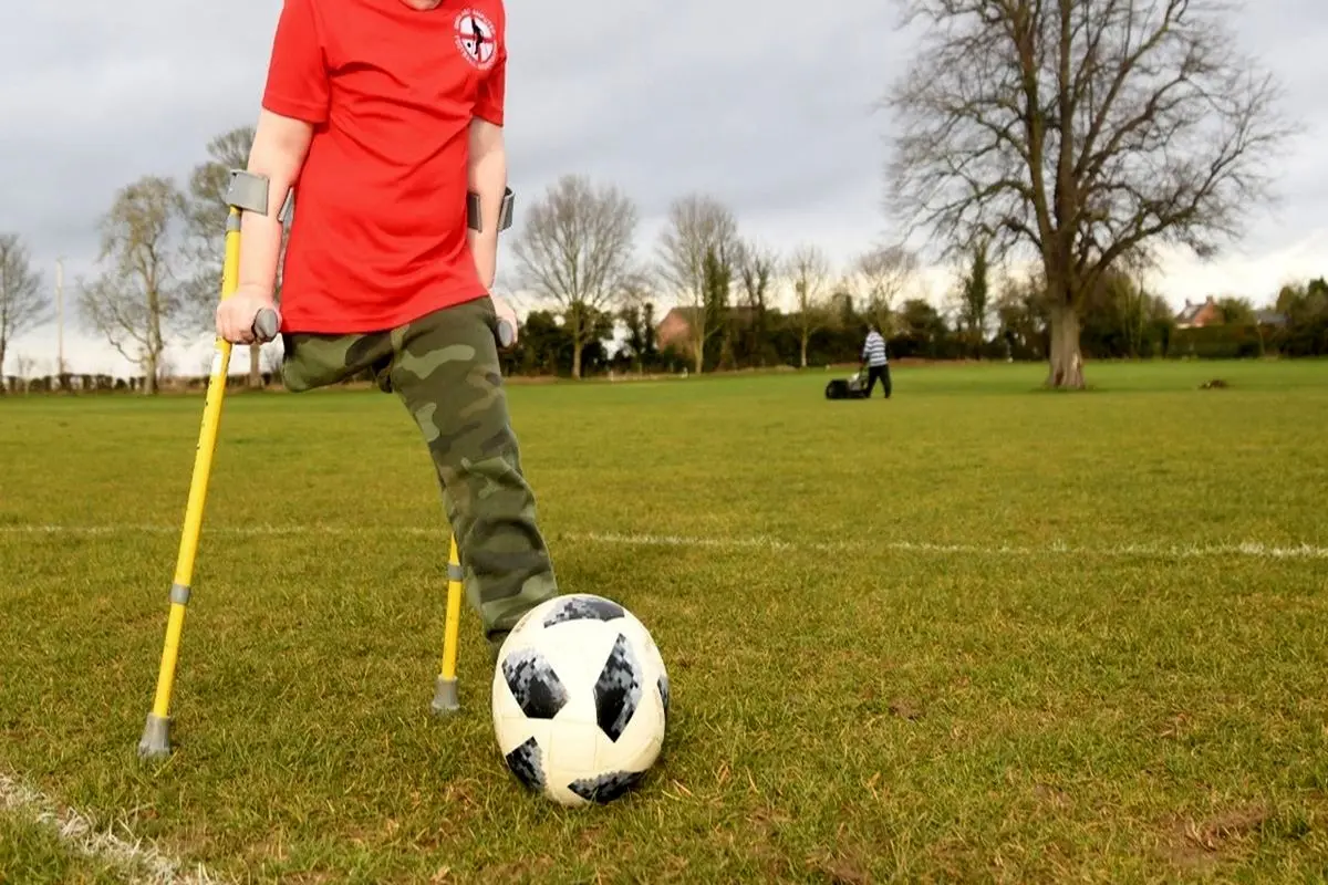 فوتبال بازی کردن کودکی با یک پا!+ فیلم