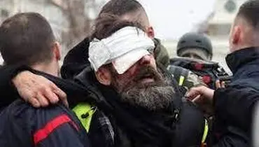 شلیک پلیس فرانسه به چشم یک شهروند در پاریس!+ فیلم