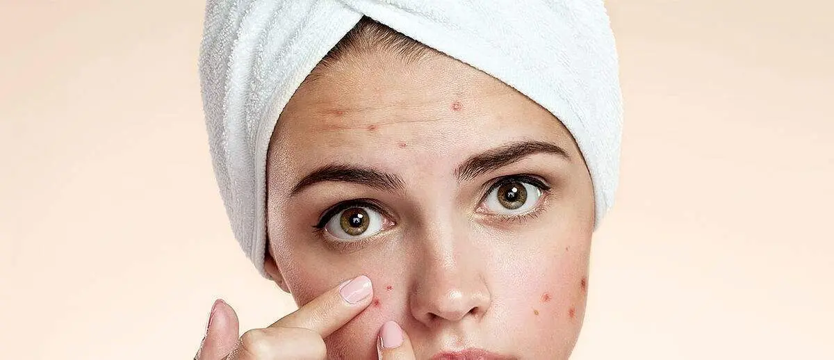 آیا رابطه جنسی باعث بروز جوش و آکنه می شود؟