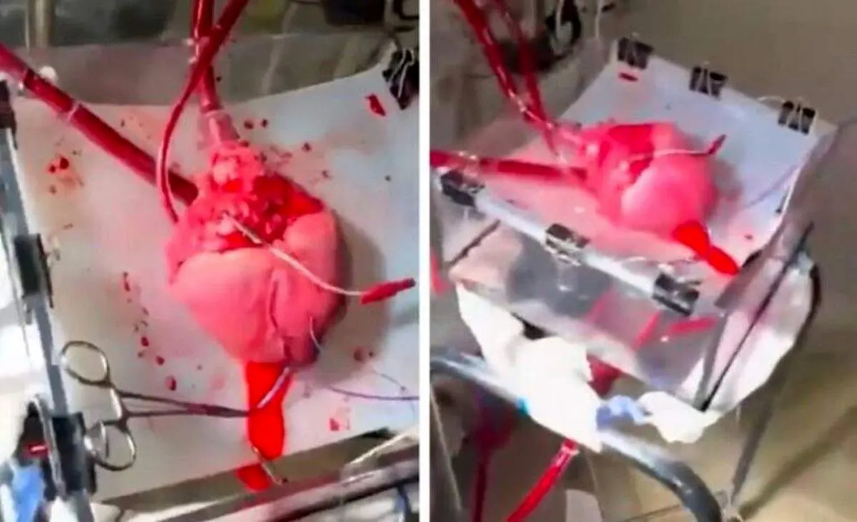 تصاویری شگفت انگیز از ضربان قلب در خارج از بدن پیش از پیوند!+ فیلم