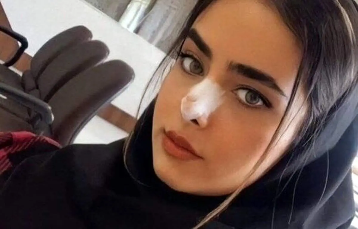 تازه‌ترین روایت: «آیلار» مست بود، تلوتلو می‌خورد / الگوی ناکارآمد روایت‌های رسمی از علت مرگ جانباختگان چیست؟