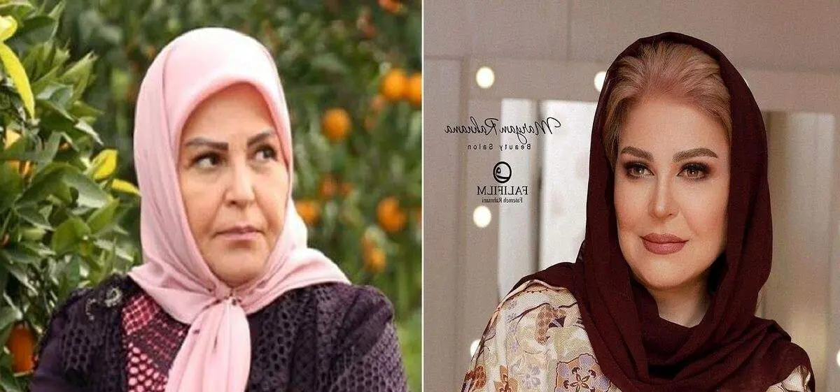 اکرم محمدی حسابی جوون شده+ عکس جذاب