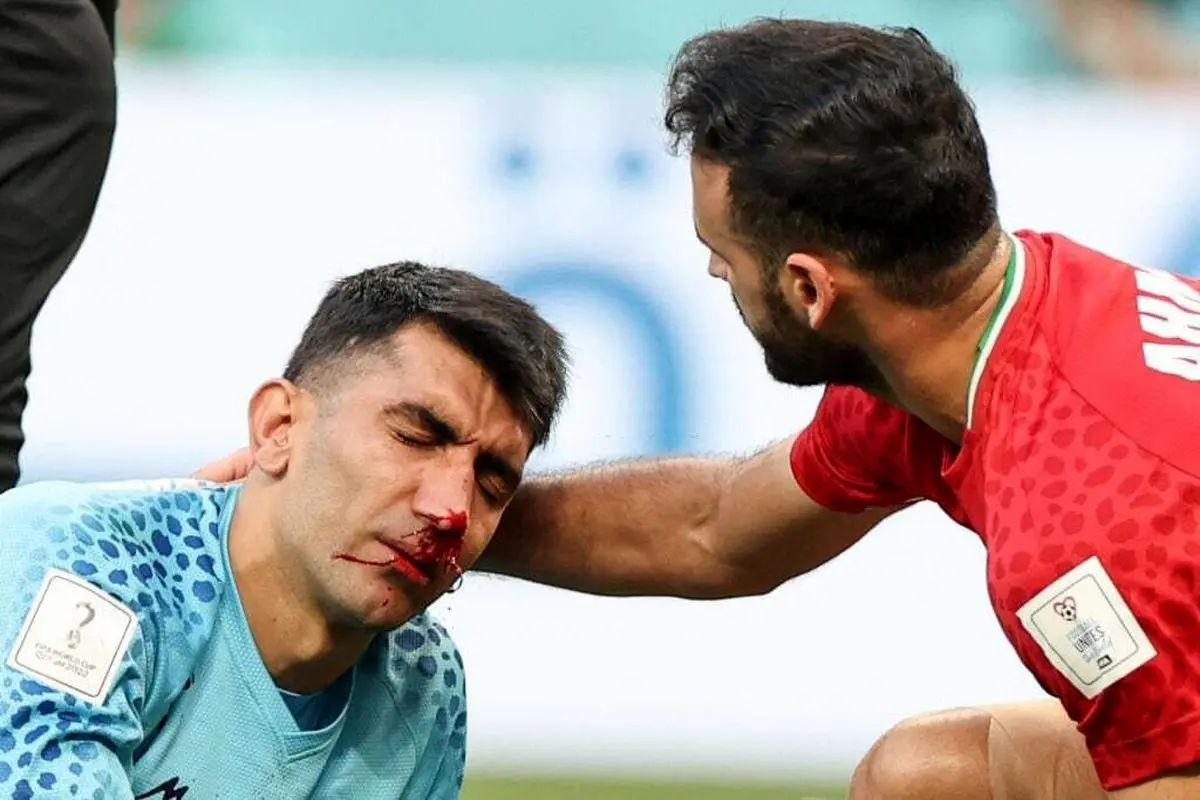 لحظه تلخ سر به سر شدن علیرضا بیرانوند و مجید حسینی در بازی مقابل انگلیس + فیلم