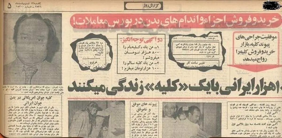 آماری وحشتناک از فروش اعضای بدن در سال ۵۶+عکس