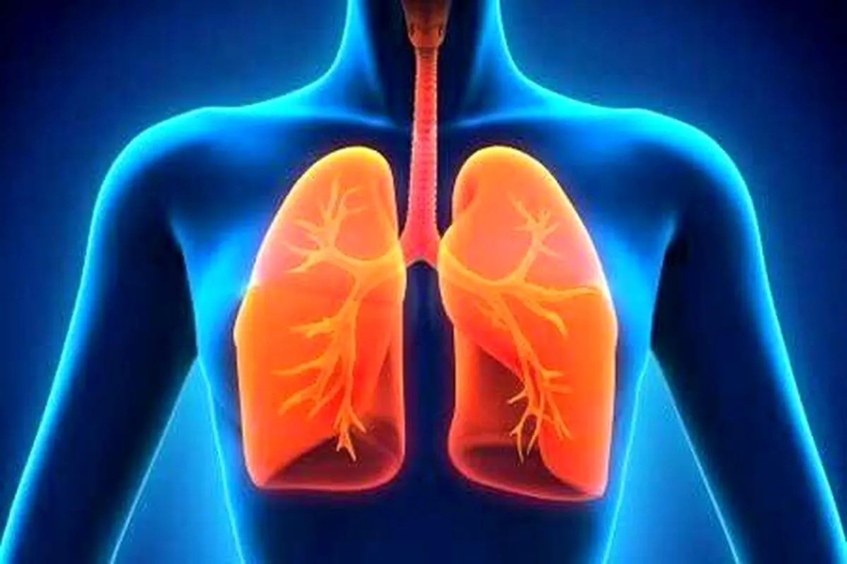 بهترین آنتی‌بیوتیک و داروی عفونت ریه را یشناسید