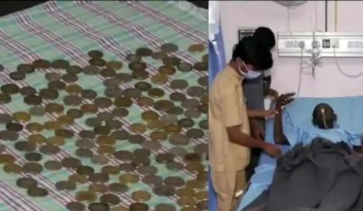 خارج کردن ۱۸۷ سکه از معده یک مرد!+ فیلم