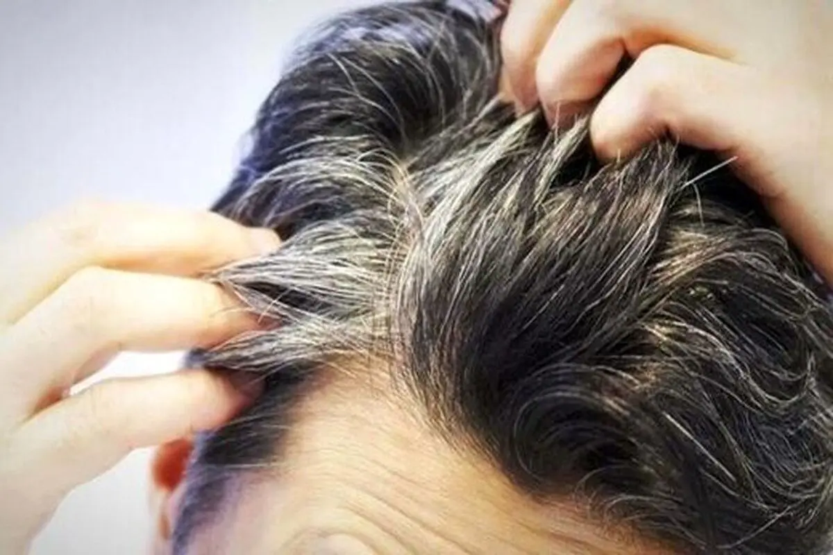 چند اقدام پیشگیرانه برای جلوگیری از سفید شدن مو