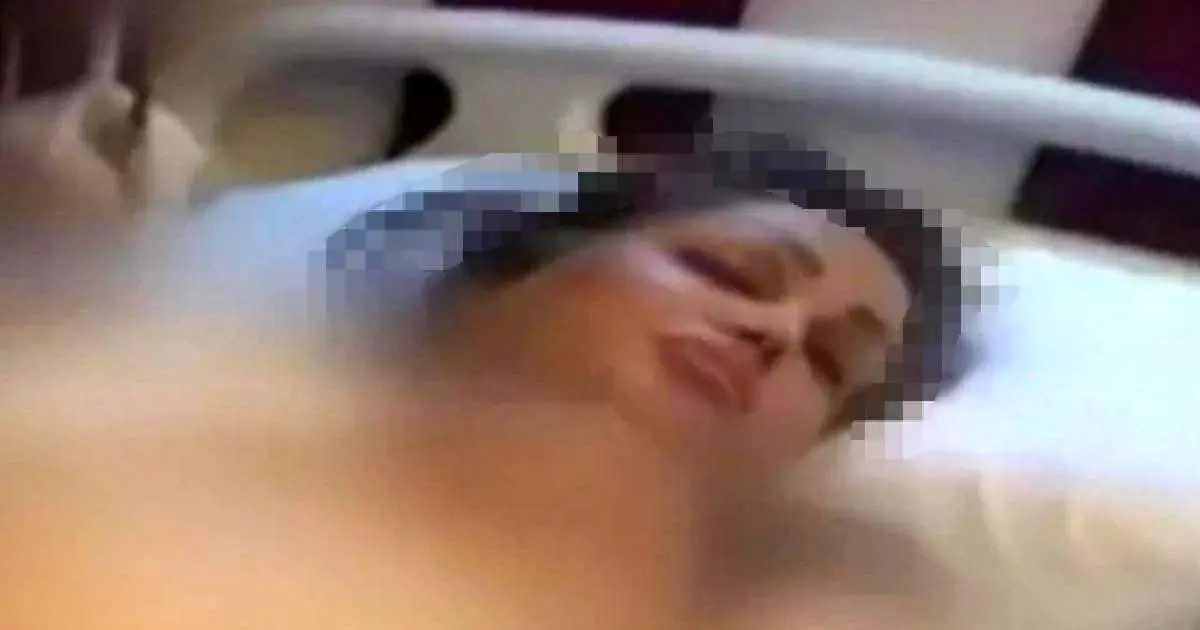 عمل زیبایی یک زن ایرانی در ترکیه فاجعه آفرید!