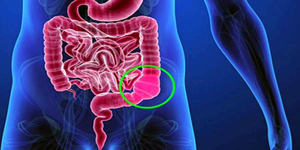 12 روش ساده برای درمان یبوست و پیشگیری از آن